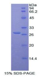 SDS-PAGE (CTNNB1-5747H).jpg